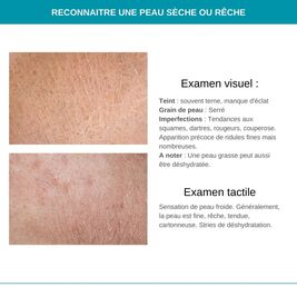 Conseils peau sèche